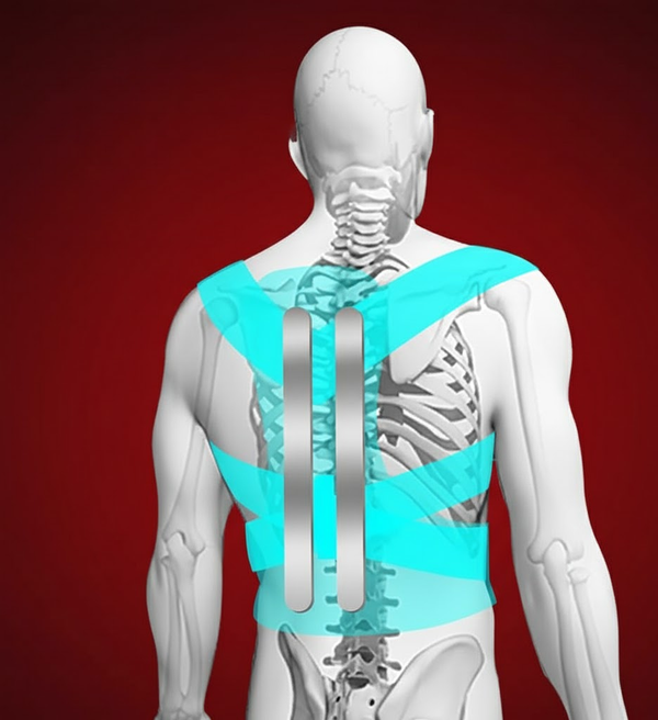 How does a posture corrector work?